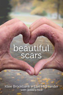 Beautiful Scars_Cover copy